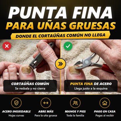 Cortaúñas común contra cortaúñas de punta fina en una uña gruesa